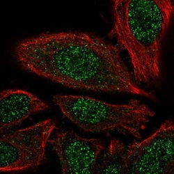 PSMD7 Antibody, Novus Biologicals 25 &mu;L, Unlabeled:Antibodies, Polyclonal